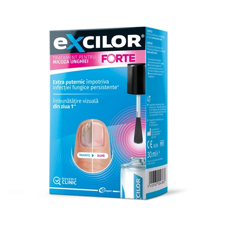 Excilor Forte, 30ml, Magna Pharm